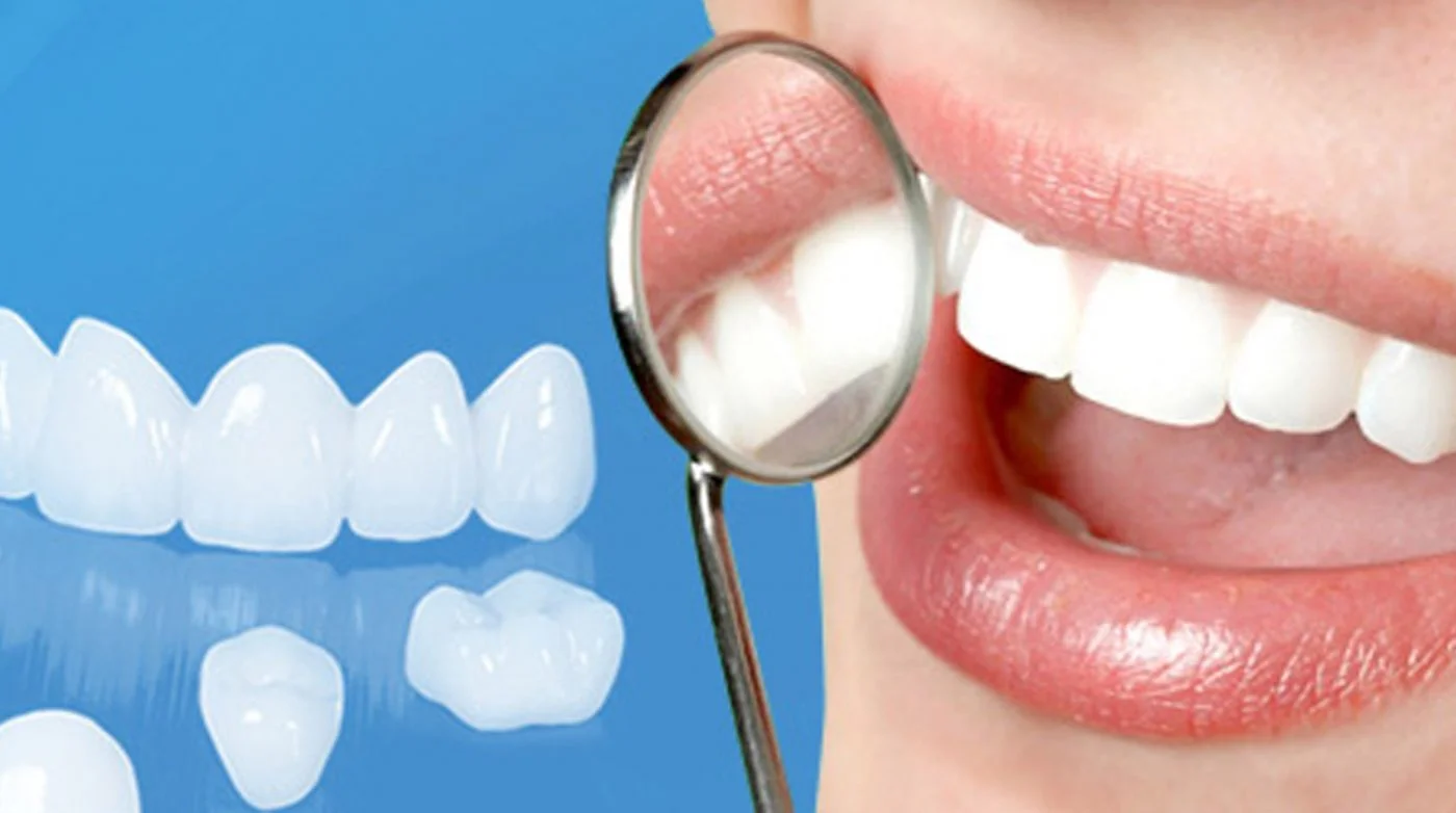 Địa chỉ trồng răng implant uy tín tại Vinh